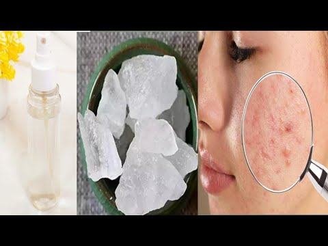 عوارض جانبی احتمالی زاج سفید